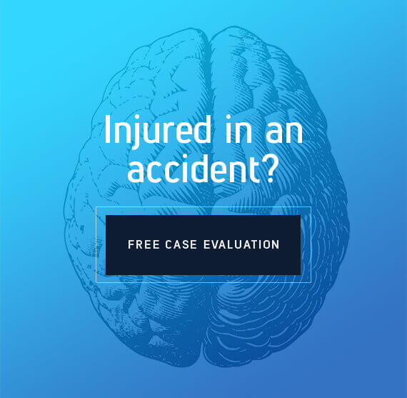 San Diego Brain Injury Lawyer