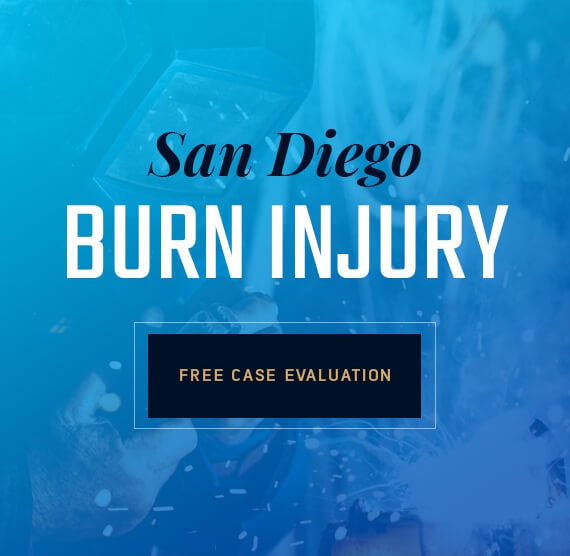 San Diego Burn Injury Attorney