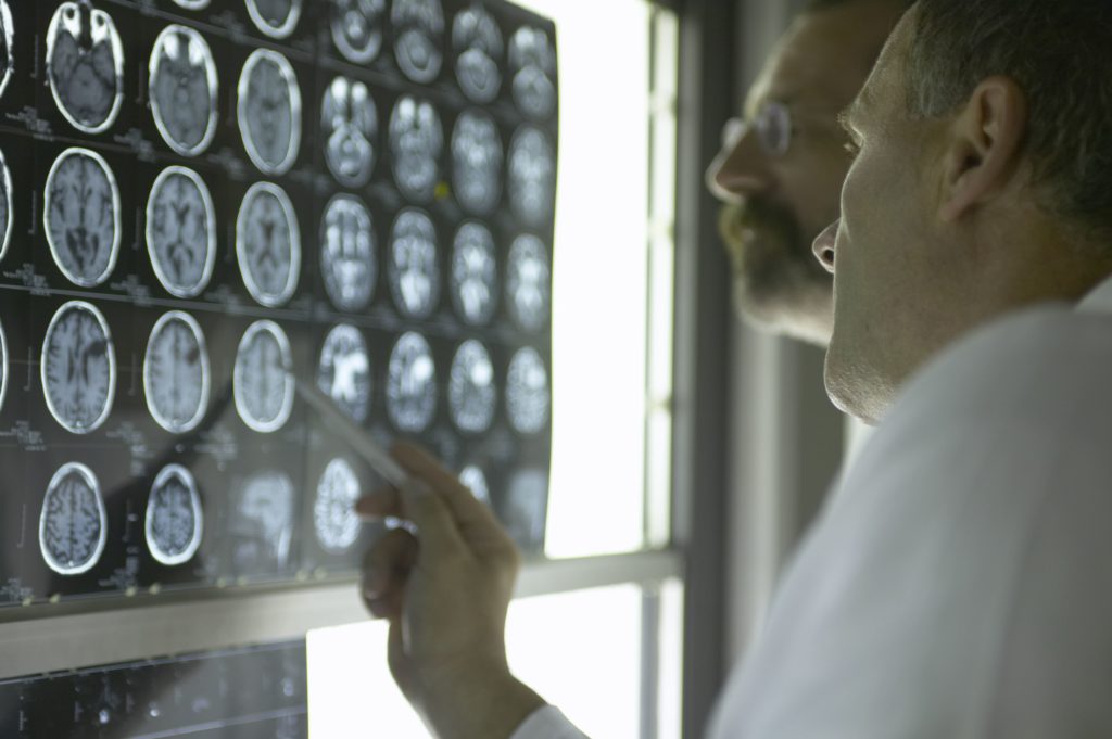 Hypoxic Brain Injury Signs